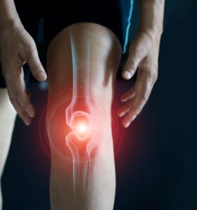 Болять коліна при згинанні? Причини болю та методи лікування